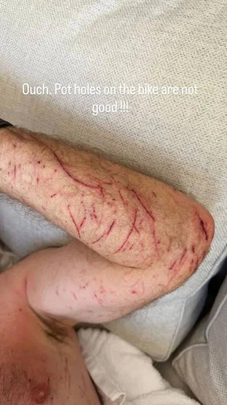  突发焦虑：从希勒骑行摔伤看运动安全防范机制 健康养生