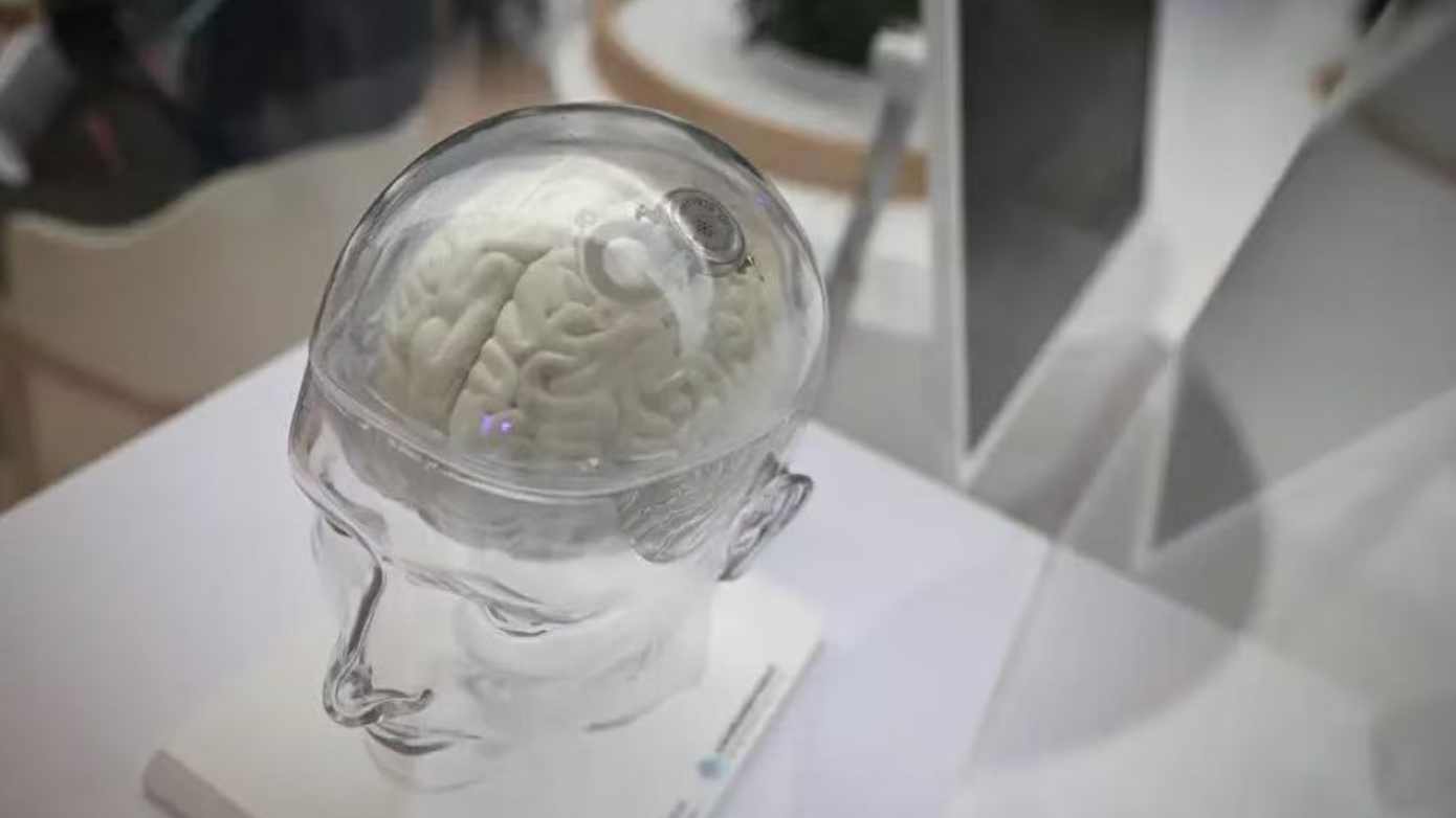  【深度拆解】脑机接口赛道：A股24只概念股投资逻辑与选股策略 股票财经